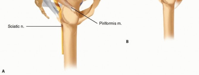 Illustration 29 for Emergency Fixation of the Pelvis: Control Bleeding & Restore Stability