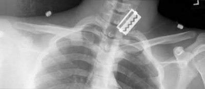 Illustration 44 for OrthoCash: Trauma MCQs & Cases for a yearold woman