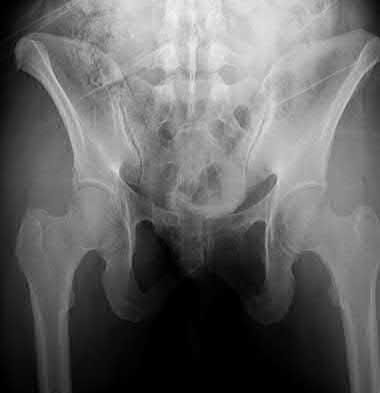Illustration 193 for OrthoCash: Trauma MCQs & Cases for a yearold woman