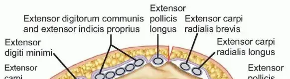 صورة توضيحية لـ كسور الكعبرة البعيدة: دليل شامل للمرضى في اليمن والخليج العربي مع الأستاذ الدكتور محمد هطيف