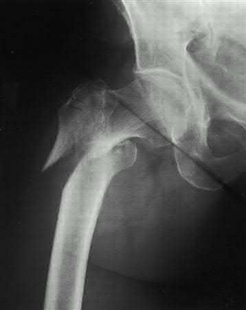 Illustration 7 for OrthoCash: Trauma MCQs & Cases for a yearold woman