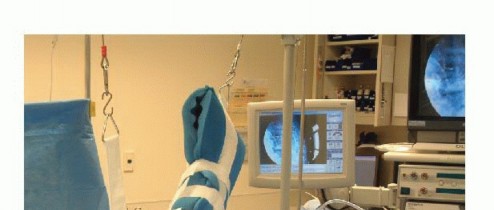 Illustration 11 for Regain Stability: Arthroscopy for Anterior Instability & the Inferior Glenohumeral Ligament