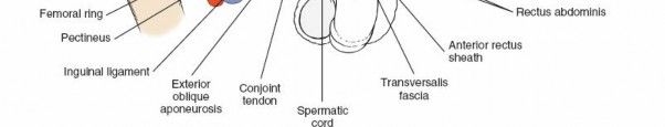 Illustration 63 for Ilioinguinal Approach: Master the Deep Inguinal Ring for Success