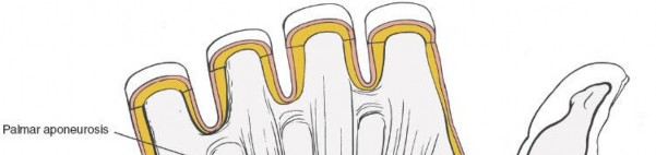 Illustration 58 for Volar Approach: Optimal Exposure for the Volar aspect of the Distal Radius
