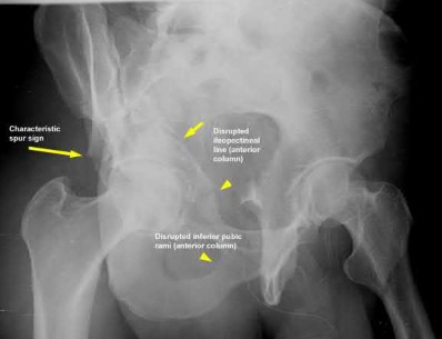 Illustration 16 for OrthoCash: Trauma MCQs & Cases for a yearold woman