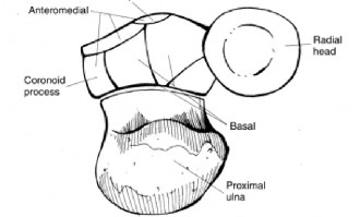 Illustration 102 for Acad Orthop Surg Challenge: Diagnose Shoulder Pain Case 1