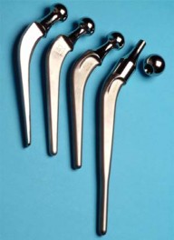 Illustration 3 for Looking for the Ideal Hip Implant? Uncover Key Factors