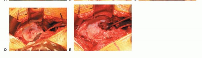صورة توضيحية لـ استبدال مفصل الورك بدون أسمنت: استعادة الحركة والثبات في صنعاء مع الأستاذ الدكتور محمد هطيف