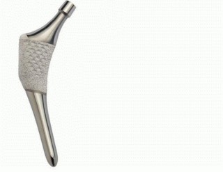 Illustration 3 for The Tapered Stem: Your Guide to Durable Cementless Hip Fixation