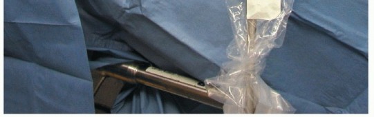 Illustration 11 for Bankart Repair & Inferior Capsular Shift: Solving Shoulder Instability