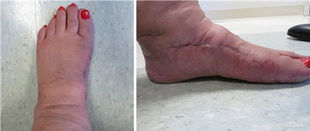 Illustration 15 for First Metatarsal Surgery: Expert Solutions for Foot & Ankle Pain