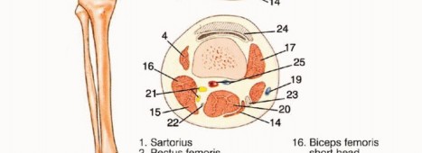 Illustration 5 for Mastering Above-Knee Amputation: Essential Surgical Insights