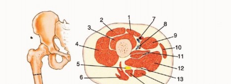 Illustration 3 for Mastering Above-Knee Amputation: Essential Surgical Insights