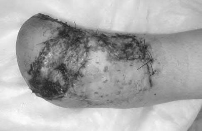 Illustration 160 for OrthoCash: Trauma MCQs & Cases for a yearold woman