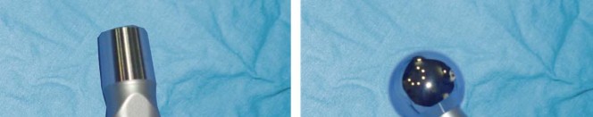 Illustration 25 for Considering METHA Short Stem? Discover Bone-Preserving THA