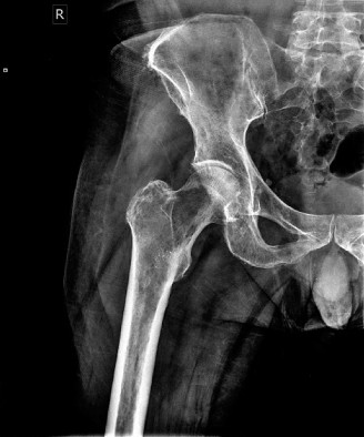 Illustration 3 for Mastering Oncology Cases: Diagnosing Myeloma & Treatment