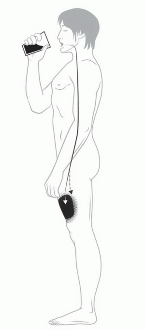 Illustration 7 for Targeted Ablation of Musculoskeletal Tumors: A Safer Approach