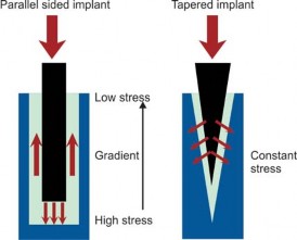 Illustration 44 for Mastering Hip Arthroplasty: Its Evolution and Design Unveiled