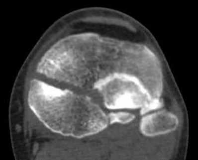 Illustration 40 for OrthoCash: Trauma MCQs & Cases for a yearold woman