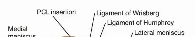 صورة توضيحية لـ تنظير الركبة: دليلك الشامل لاستعادة حركة خالية من الألم مع الأستاذ الدكتور محمد هطيف