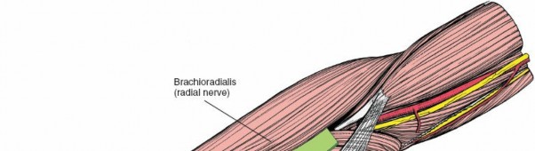 Illustration 4 for Radius Anterior Approach: Safe Nerve Protection & Complete Exposure