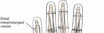 Illustration 139 for Essential Surgical Approaches: Uncover Every Aspect of the Wrist