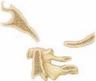 Illustration 6 for Cervical Fusion: The Line is Drawn for Lasting Stability