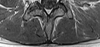 Illustration 21 for OrthoCash: Trauma MCQs & Cases for a yearold woman
