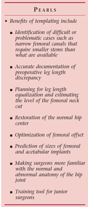Templating for Primary THA: Optimize Outcomes & Avoid Pitfalls