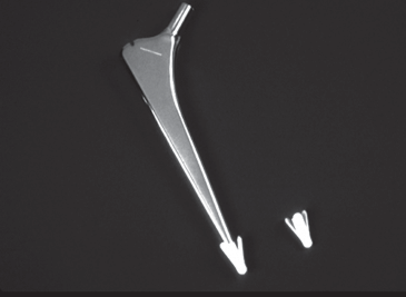 Unlocking Optimal Hip Implants: Metal on Metal Choices Explained