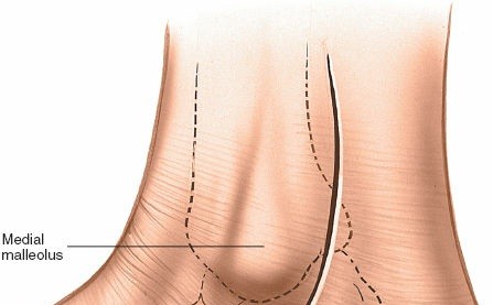 Illustration 25 for Optimized Approaches to the Dorsum of the Foot & Ankle