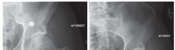 Illustration 9 for Hip Arthroscopy: Your Minimally Invasive Solution for Hip Pain
