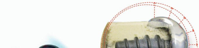 Illustration 11 for End Articular Cartilage Loss: Arthrosurface HemiCAP Resurfacing