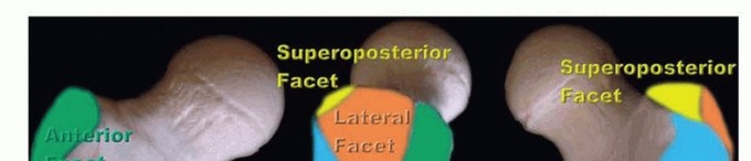 Uncover Hip Pain Secrets: Focus on the Facet of the Greater via Arthroscopy