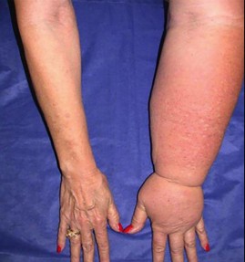 صورة طبية: دليل الأستاذ الدكتور محمد هطيف الشامل لأمراض وإصابات اليد والمعصم في صنعاء