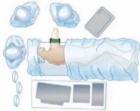 Illustration 7 for Precision Arthroscopy for Chondral Injuries & OCD: Direct Lateral Portal