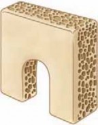 Illustration 10 for Cervical Fusion: The Line is Drawn for Lasting Stability