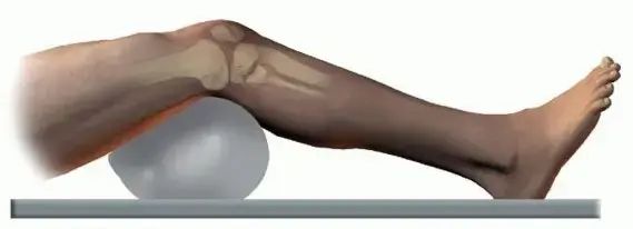 صورة توضيحية لـ كسور الهضبة الظنبوبية الجانبية: دليلك الشامل لاستعادة الحركة مع الدكتور محمد هطيف