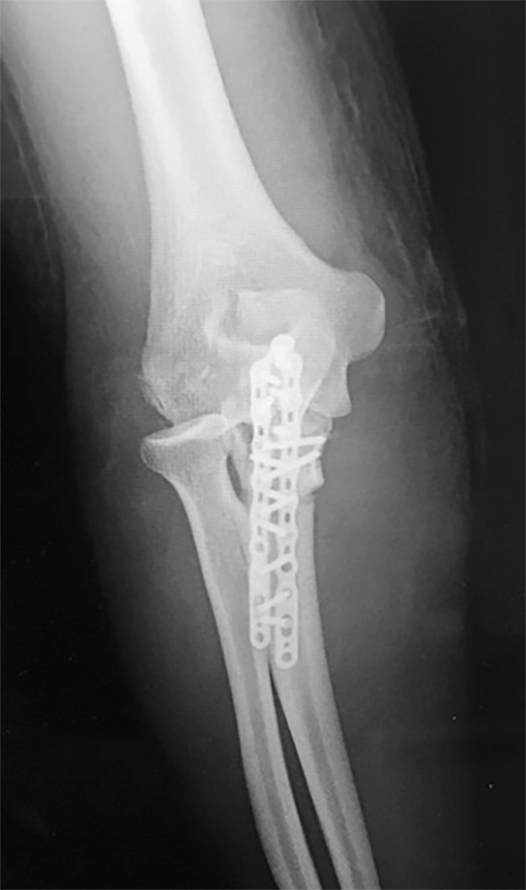 Orthopedic Surgery Mock Exam - Set 1F7639