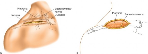 Illustration 3 for Essential Guide: Mastering Every Approach to the Shoulder