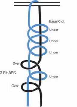 Illustration 34 for Arthroscopic Subscapularis Repair: The lo iky brady Method for Stability