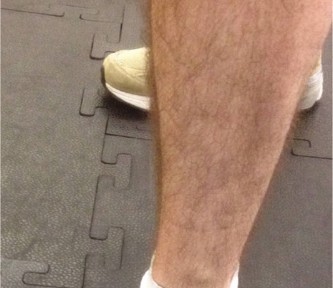 Illustration of deep posterior compartment - Dr. Mohammed Hutaif