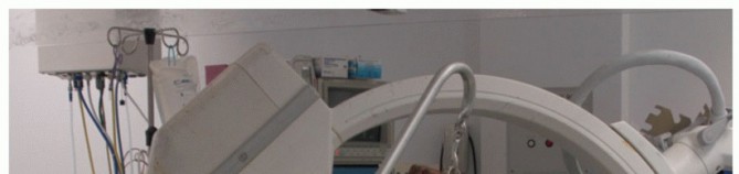 Illustration 3 for Optimizing Fixation of Proximal Humerus Fractures: A Guide