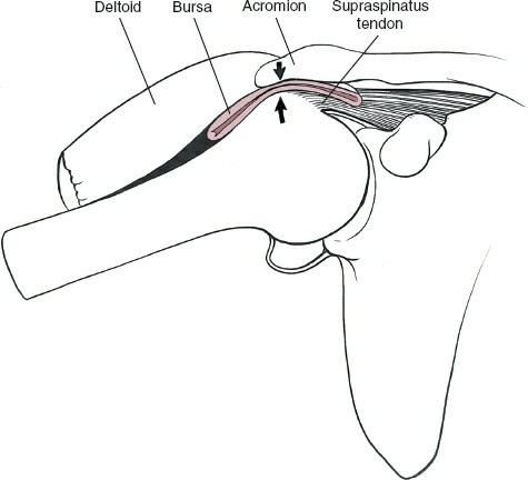 Illustration 22 for Deepen Skills: Anterolateral & Lateral Surgical Approaches