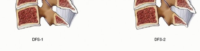 Illustration 28 for Master Techniques for Cervical Fracture Reduction: Type III & More