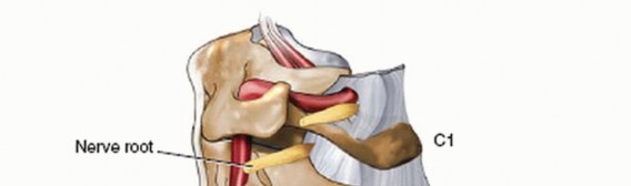 Illustration 23 for Master Techniques for Cervical Fracture Reduction: Type III & More
