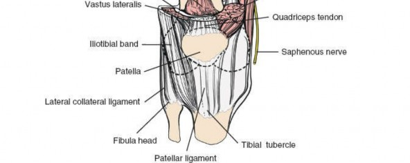 Illustration 114 for Optimal Femoral Approaches: Mastering the Lateral Intermuscular Septum