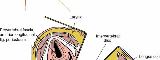 Illustration 257 for Approach to the Lumbar Spine: Mastering Techniques & Anatomy
