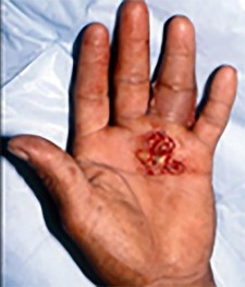 صورة توضيحية لـ دليل الأستاذ الدكتور محمد هطيف الشامل لأمراض وإصابات اليد والمعصم في صنعاء