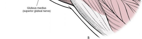 Illustration 23 for Unlocking Every Aspect of the Hip's Surgical Approaches